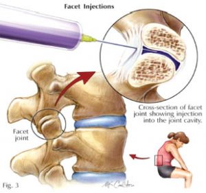 kuwait_hospital_physical_medicine_and_rheumatology_26