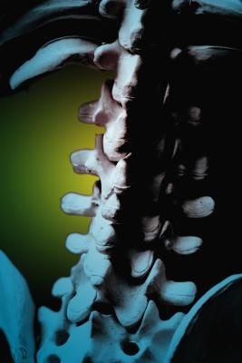 Degeneration of the Spine Symptoms