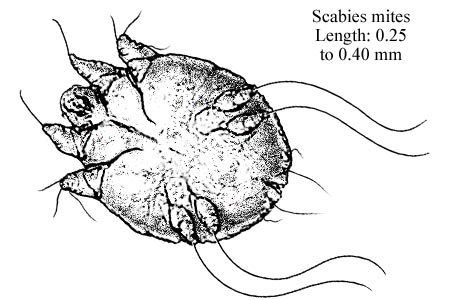 What to Do If You Have Scabies or Lice?