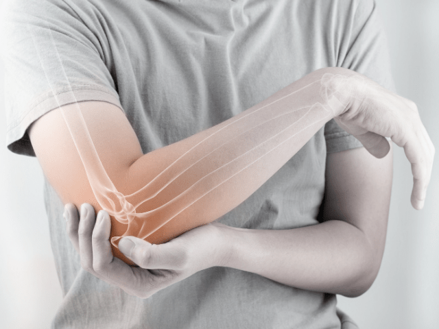 How to Manage Arthritis Pain?